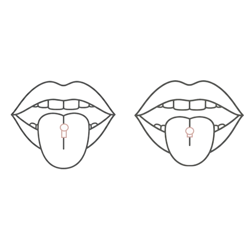 Illustration comparative de deux piercings langue titane : à gauche avec une barre longue pour le gonflement initial, à droite avec une barre ajustée après cicatrisation.